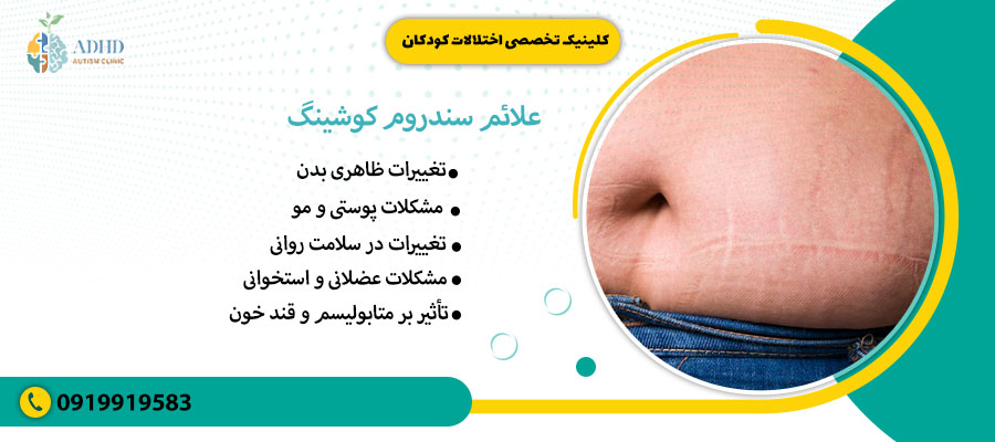 علائم سندروم کوشینگ